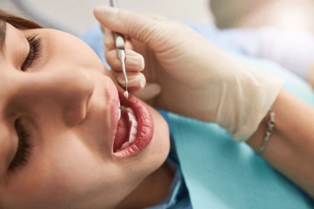dental-fillings-near-you