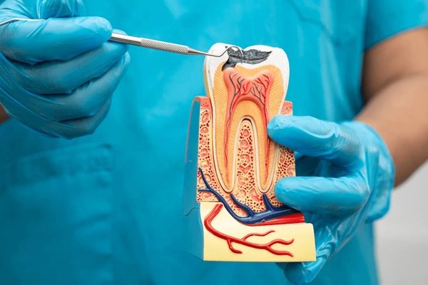 root-canal-treatments-near-you